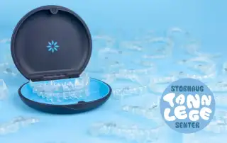 Fordelene med Invisalign Hvorfor velge denne moderne tannreguleringen i Stavanger